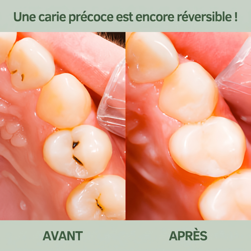 Haldrek – Chewing-gum reminéralisant | Stop aux caries